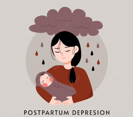 Understanding Postpartum Depression